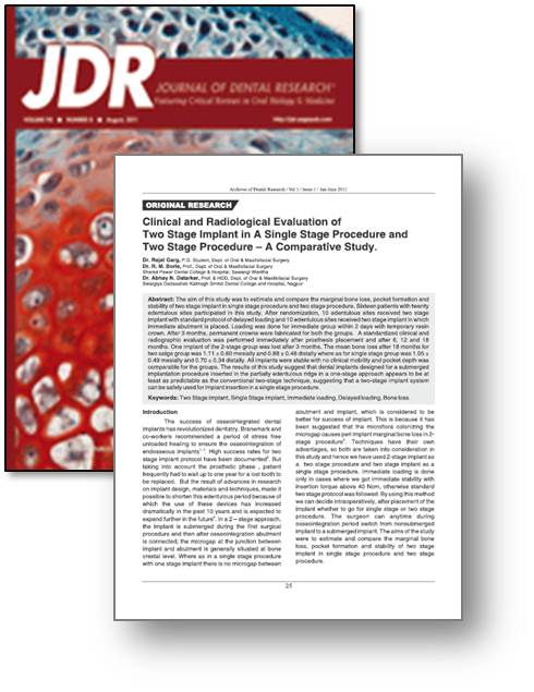 Evaluación clínica y radiológica de implantes de dos piezas en procedimientos de una fase y procedimientos de dos fases - estudio comparativo